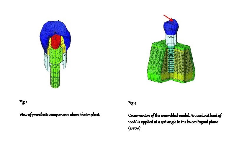 Fig 2 Fig 4 View of prosthetic components above the implant. Cross-section of the