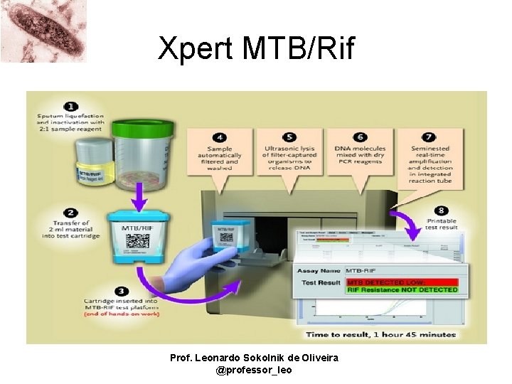 Xpert MTB/Rif Prof. Leonardo Sokolnik de Oliveira @professor_leo 