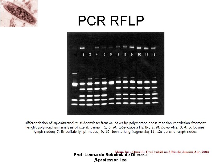 PCR RFLP Prof. Leonardo Sokolnik de Oliveira @professor_leo 