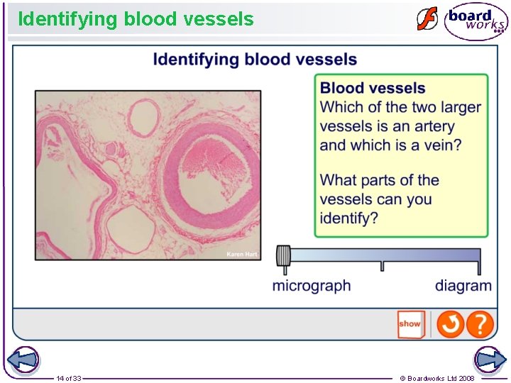 Identifying blood vessels 14 of 33 © Boardworks Ltd 2008 