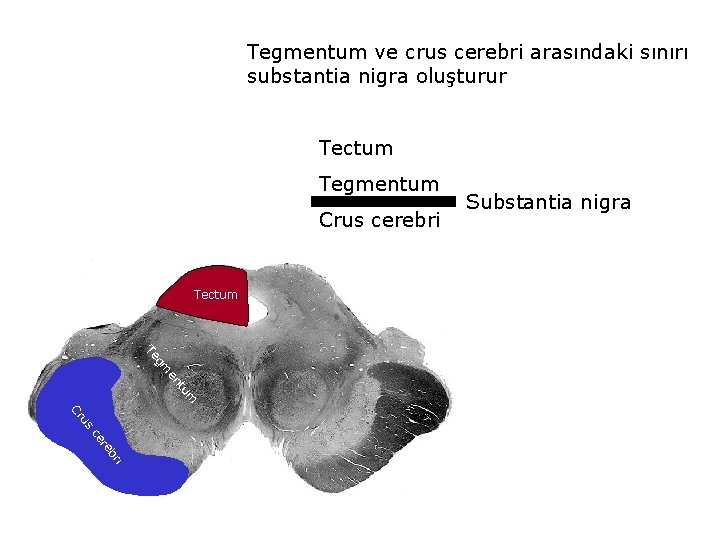 Tegmentum ve crus cerebri arasındaki sınırı substantia nigra oluşturur Tectum Tegmentum Crus cerebri Tectum