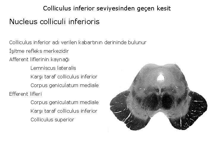 Colliculus inferior seviyesinden geçen kesit Nucleus colliculi inferioris Colliculus inferior adı verilen kabartının derininde