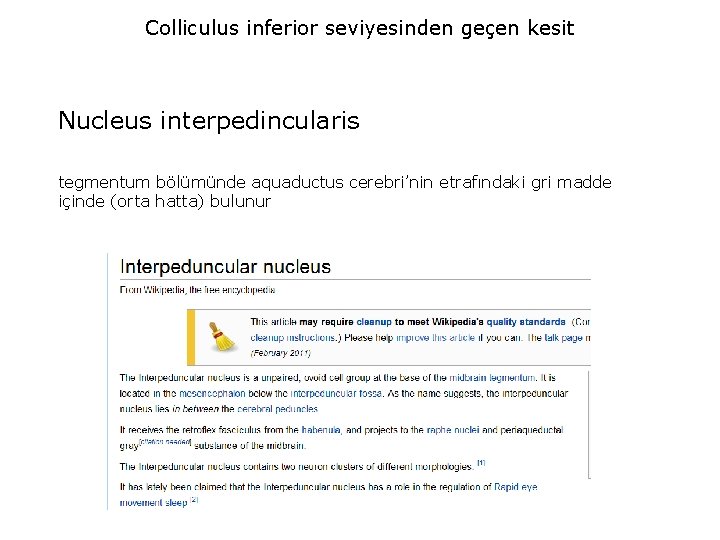 Colliculus inferior seviyesinden geçen kesit Nucleus interpedincularis tegmentum bölümünde aquaductus cerebri’nin etrafındaki gri madde