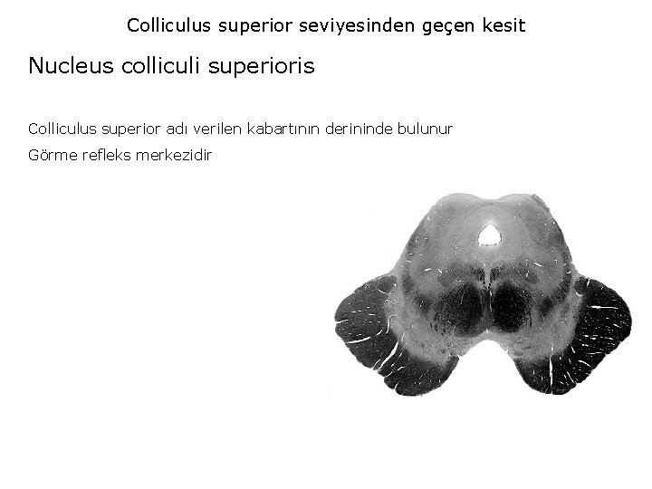 Colliculus superior seviyesinden geçen kesit Nucleus colliculi superioris Colliculus superior adı verilen kabartının derininde