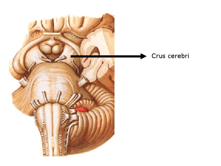 Crus cerebri 