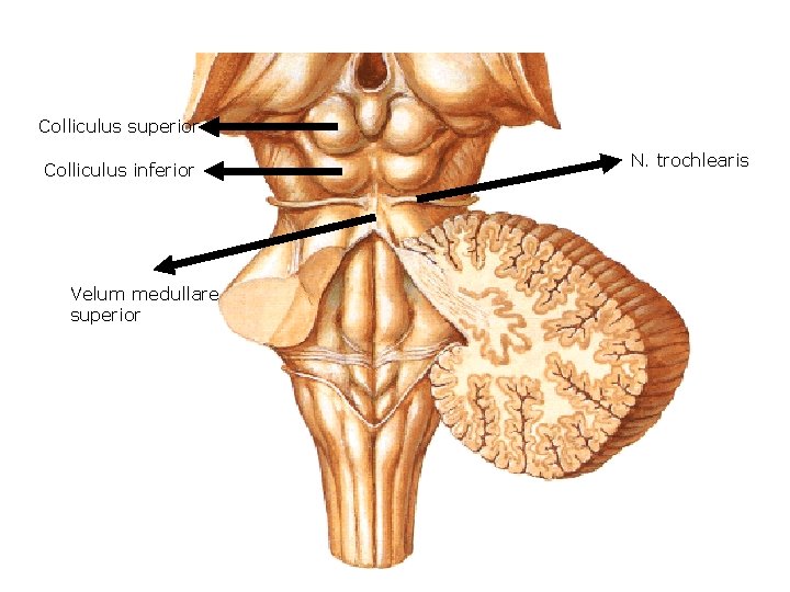 Colliculus superior Colliculus inferior Velum medullare superior N. trochlearis 