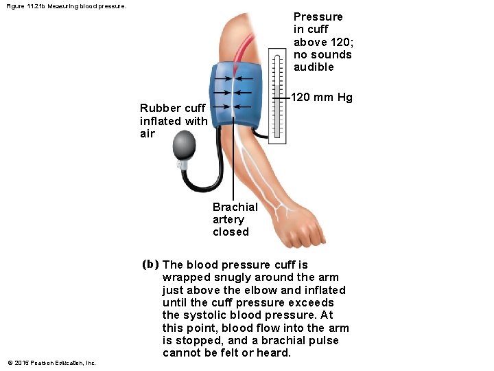 Figure 11. 21 b Measuring blood pressure. Pressure in cuff above 120; no sounds Figure 11. 21 b Measuring blood pressure. Pressure in cuff above 120; no sounds