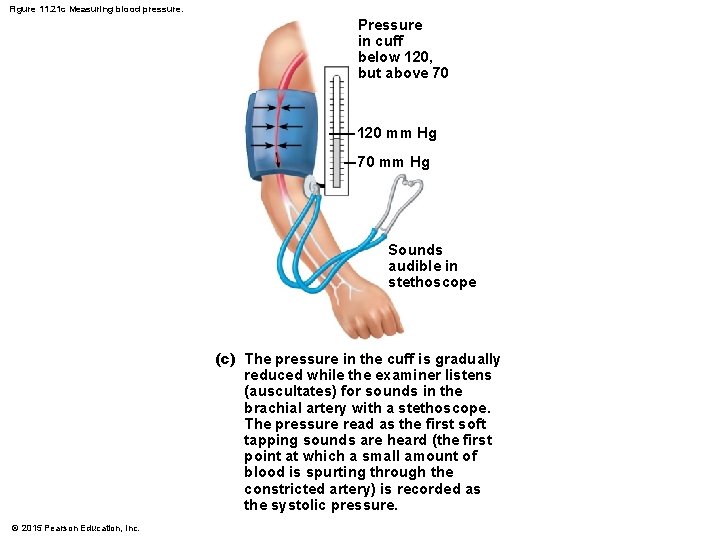 Figure 11. 21 c Measuring blood pressure. Pressure in cuff below 120, but above Figure 11. 21 c Measuring blood pressure. Pressure in cuff below 120, but above