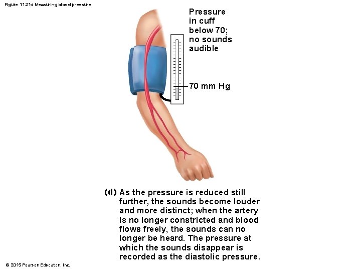 Figure 11. 21 d Measuring blood pressure. Pressure in cuff below 70; no sounds Figure 11. 21 d Measuring blood pressure. Pressure in cuff below 70; no sounds
