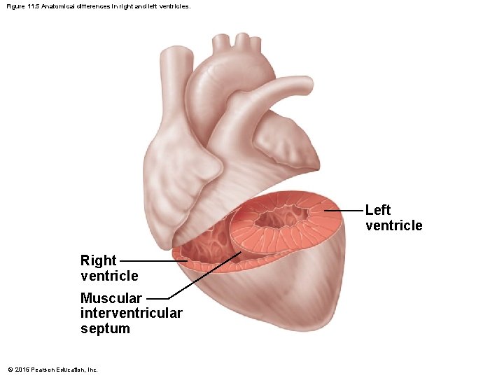 Figure 11. 5 Anatomical differences in right and left ventricles. Left ventricle Right ventricle