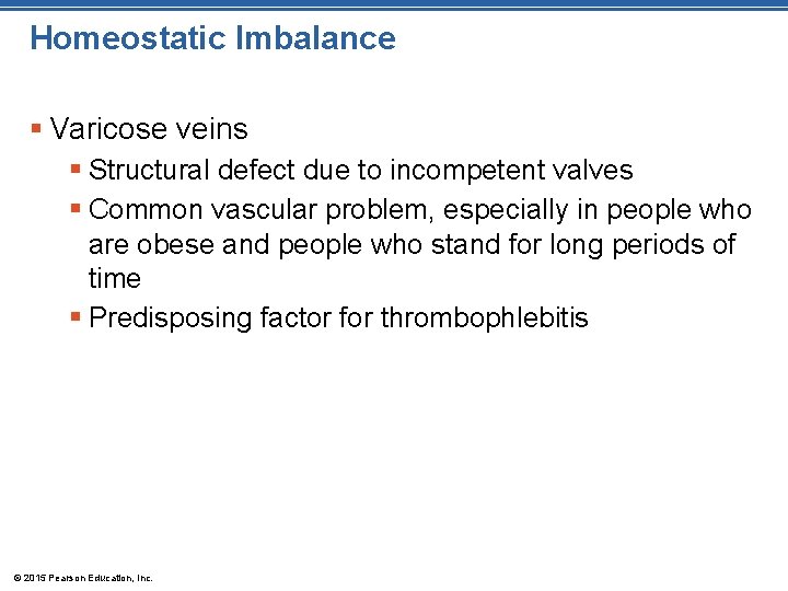 Homeostatic Imbalance § Varicose veins § Structural defect due to incompetent valves § Common