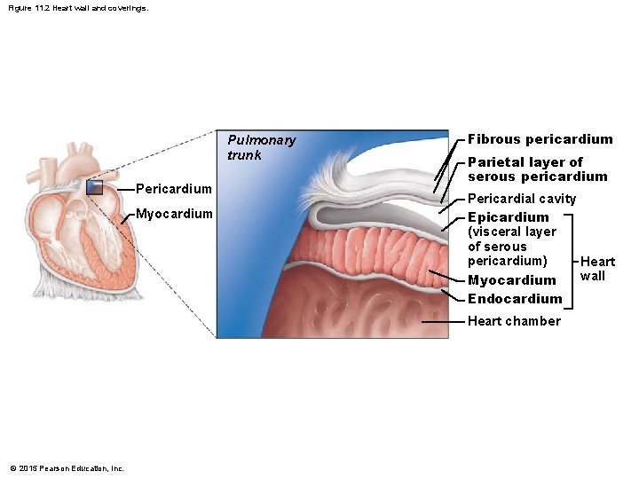 Figure 11. 2 Heart wall and coverings. Pulmonary trunk Pericardium Myocardium Fibrous pericardium Parietal
