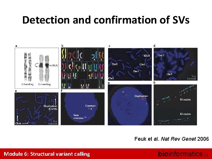 Detection and confirmation of SVs Feuk et al. Nat Rev Genet 2006 Module 6: