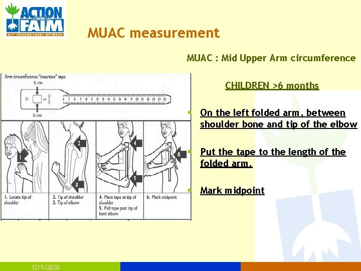 MUAC measurement MUAC : Mid Upper Arm circumference CHILDREN >6 months § On the