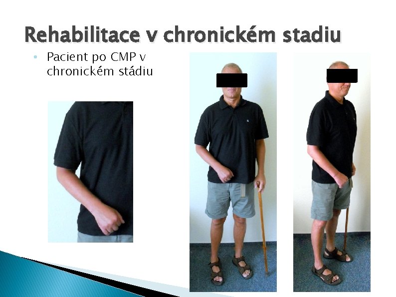 Rehabilitace v chronickém stadiu • Pacient po CMP v chronickém stádiu 