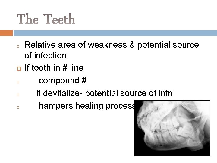 o o o o Relative area of weakness & potential source of infection If
