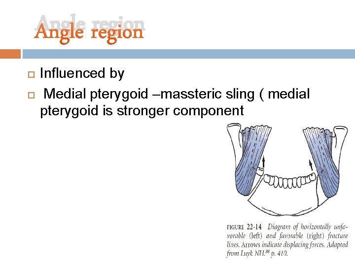 Angle region Influenced by Medial pterygoid –massteric sling ( medial pterygoid is stronger component