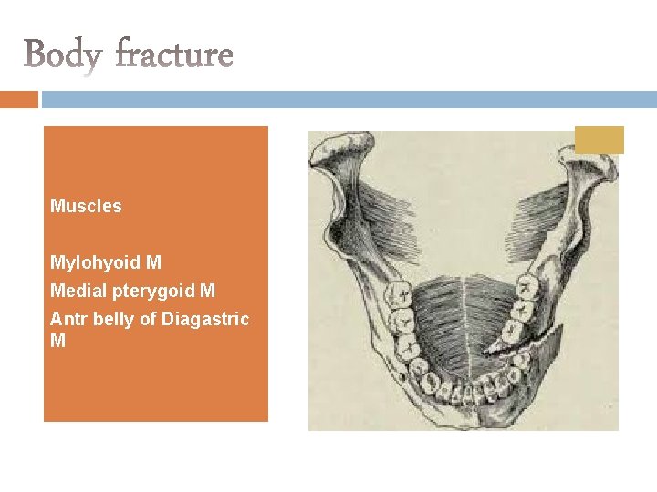 Muscles Mylohyoid M Medial pterygoid M Antr belly of Diagastric M 