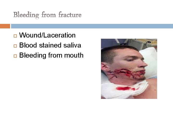 Wound/Laceration Blood stained saliva Bleeding from mouth 