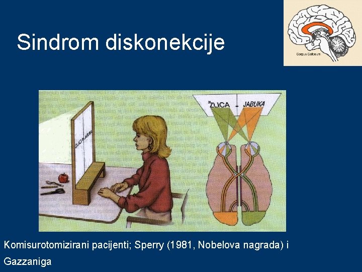 Sindrom diskonekcije Izvor: Pinel (2002); Biološka psihologija, Naklada Slap Komisurotomizirani pacijenti; Sperry (1981, Nobelova