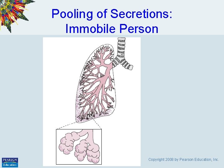 Pooling of Secretions: Immobile Person Copyright 2008 by Pearson Education, Inc. 