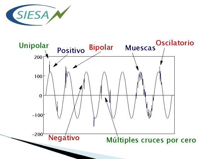 Unipolar 200 Positivo Bipolar Muescas Oscilatorio 100 0 -100 -200 Negativo Múltiples cruces por
