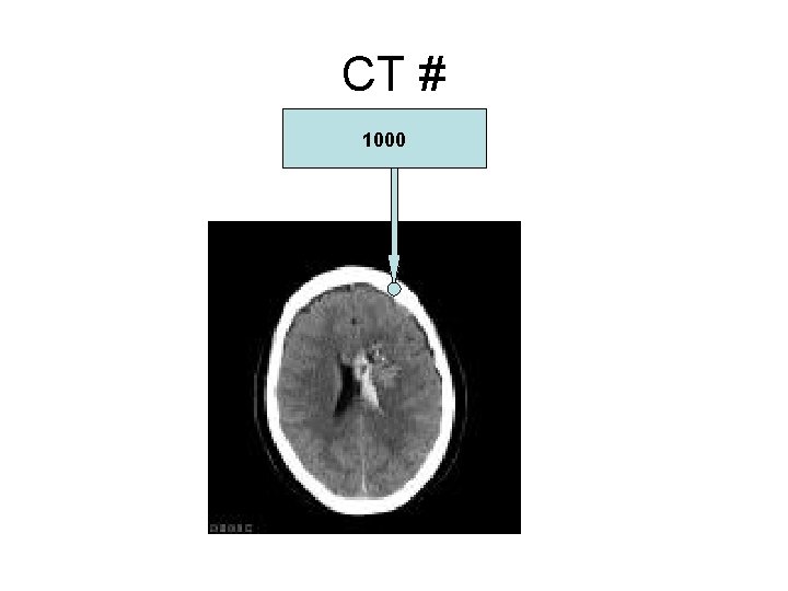 CT # 1000 