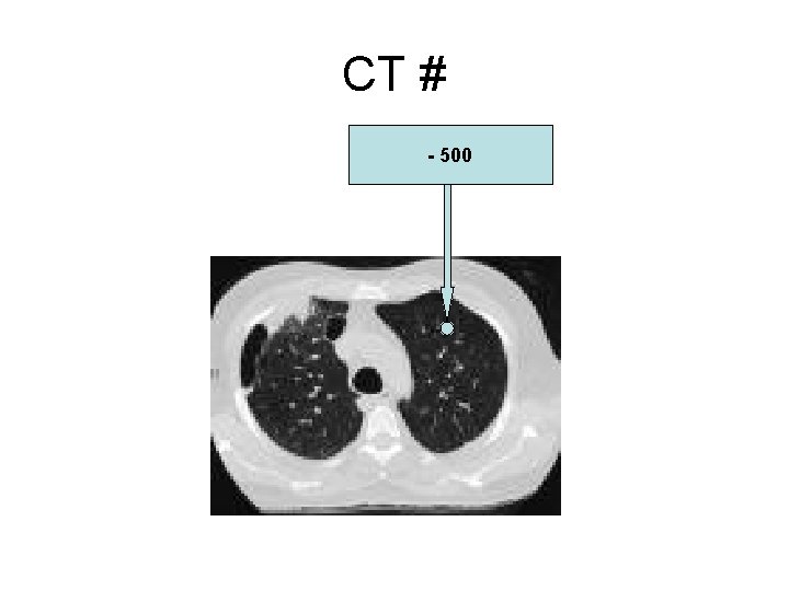 CT # - 500 