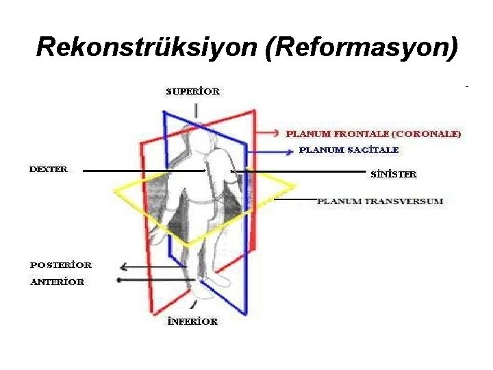 Rekonstrüksiyon (Reformasyon) 