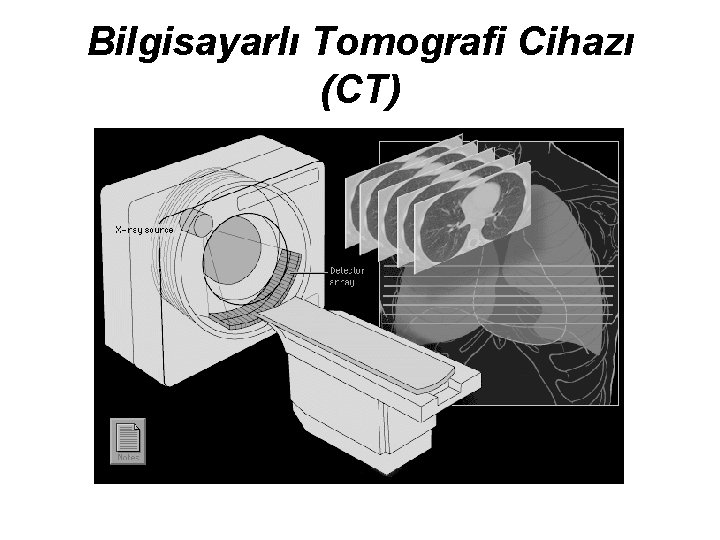 Bilgisayarlı Tomografi Cihazı (CT) 