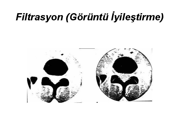 Filtrasyon (Görüntü İyileştirme) 