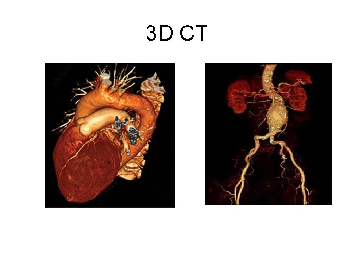 3 D CT 