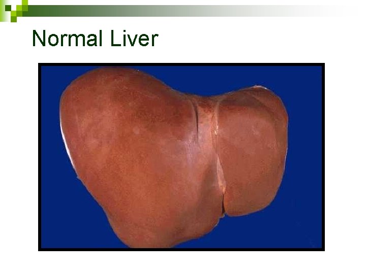 Normal Liver 