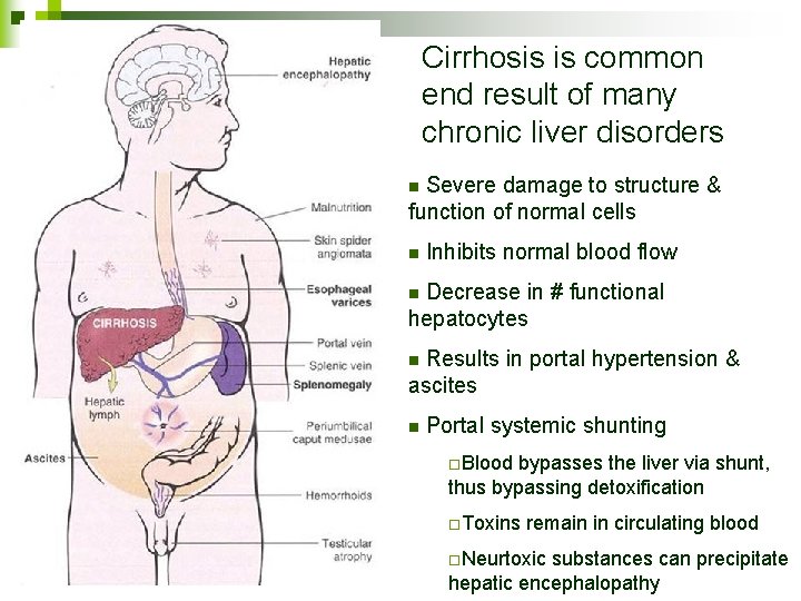 Cirrhosis is common end result of many chronic liver disorders n Severe damage to