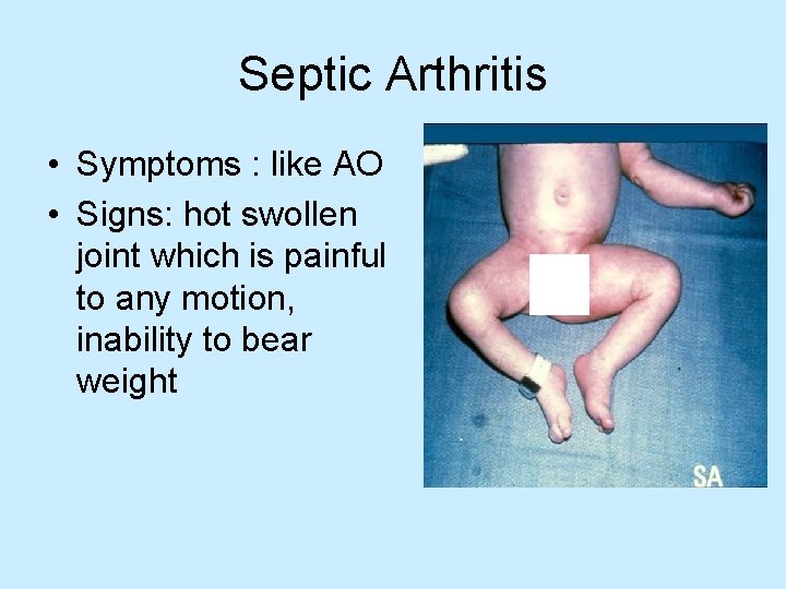 Septic Arthritis • Symptoms : like AO • Signs: hot swollen joint which is