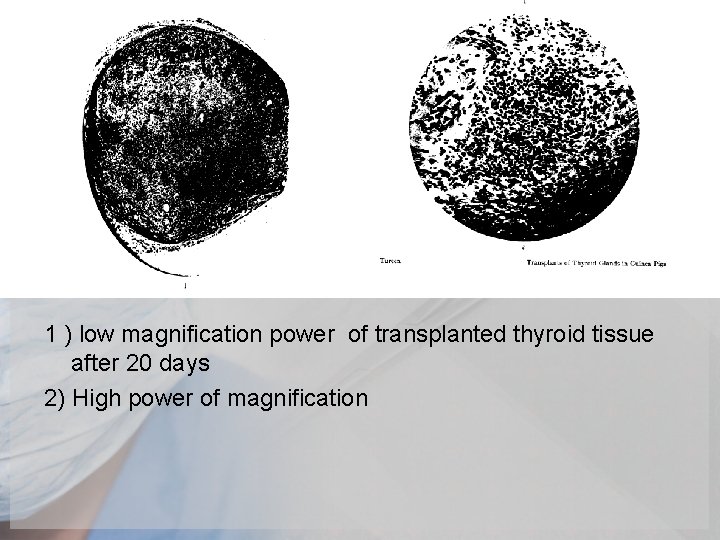 1 ) low magnification power of transplanted thyroid tissue after 20 days 2) High