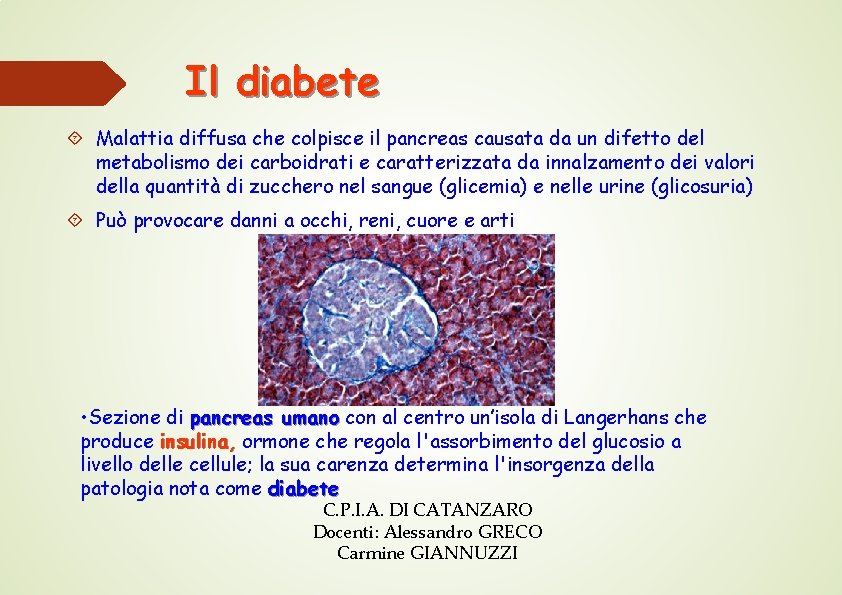Il diabete Malattia diffusa che colpisce il pancreas causata da un difetto del metabolismo