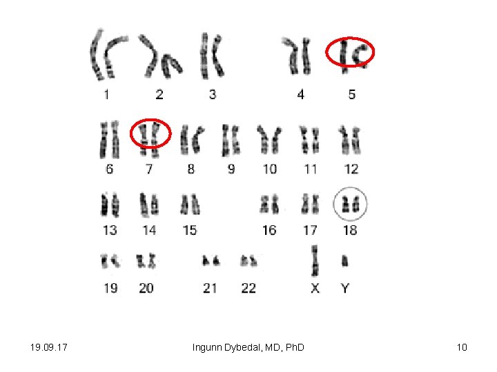 19. 09. 17 Ingunn Dybedal, MD, Ph. D 10 