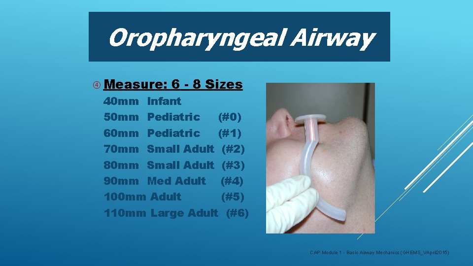 Oropharyngeal Airway Measure: 6 - 8 Sizes 40 mm Infant 50 mm Pediatric (#0)
