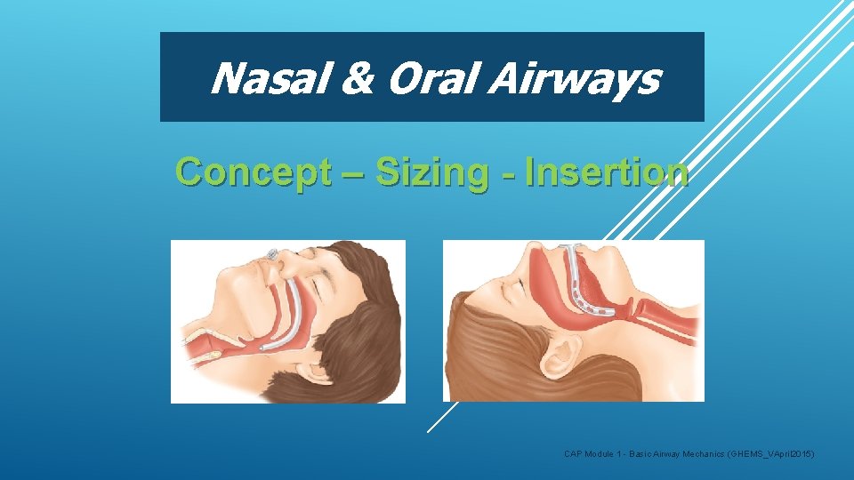 Nasal & Oral Airways Concept – Sizing - Insertion CAP Module 1 - Basic