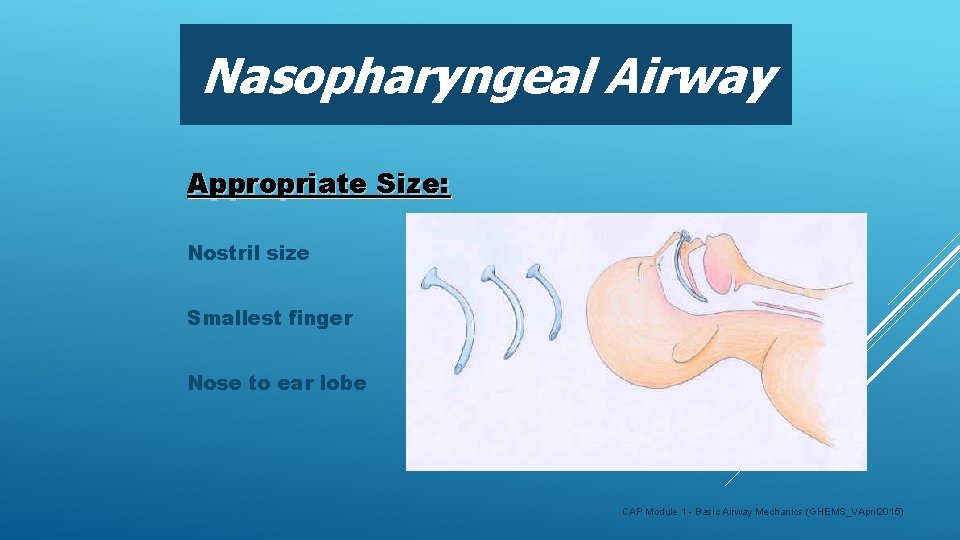 Nasopharyngeal Airway Appropriate Size: Nostril size Smallest finger Nose to ear lobe CAP Module