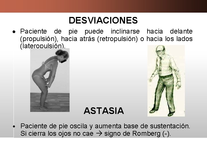 DESVIACIONES Paciente de pie puede inclinarse hacia delante (propulsión), hacia atrás (retropulsión) o hacia