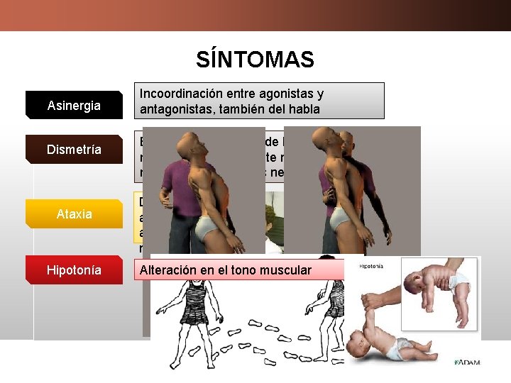 SÍNTOMAS Asinergia Dismetría Ataxia Hipotonía Incoordinación entre agonistas y antagonistas, también del habla Ejecución