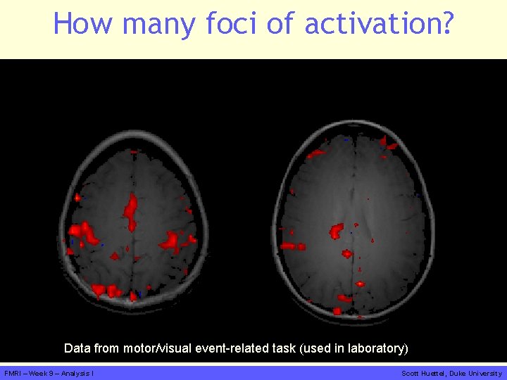 How many foci of activation? Data from motor/visual event-related task (used in laboratory) FMRI