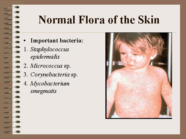 Normal Flora of the Skin • Important bacteria: 1. Staphylococcus epidermidis 2. Micrococcus sp.