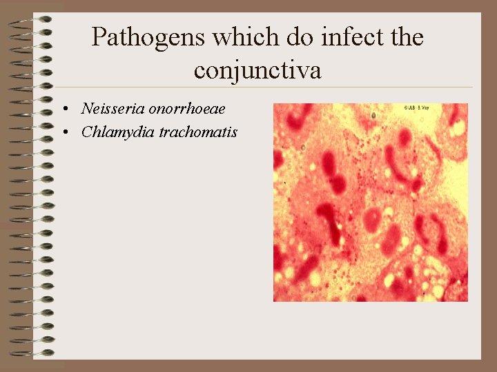 Pathogens which do infect the conjunctiva • Neisseria onorrhoeae • Chlamydia trachomatis 