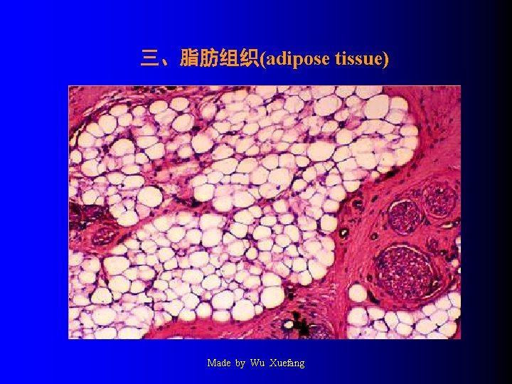 三、脂肪组织(adipose tissue) Made by Wu Xuefang 
