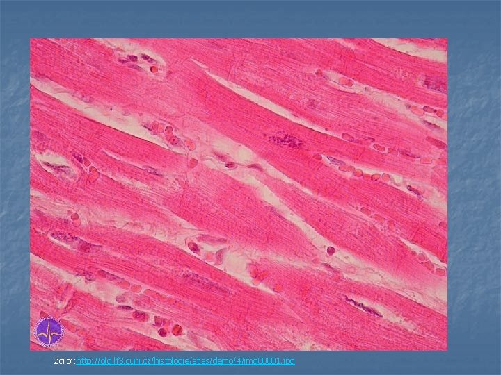 Zdroj: http: //old. lf 3. cuni. cz/histologie/atlas/demo/4/img 00001. jpg 