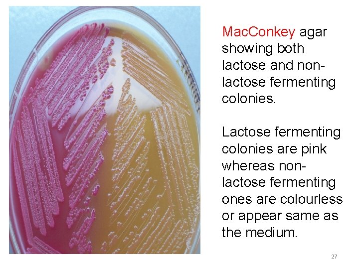 Mac. Conkey agar showing both lactose and nonlactose fermenting colonies. Lactose fermenting colonies are