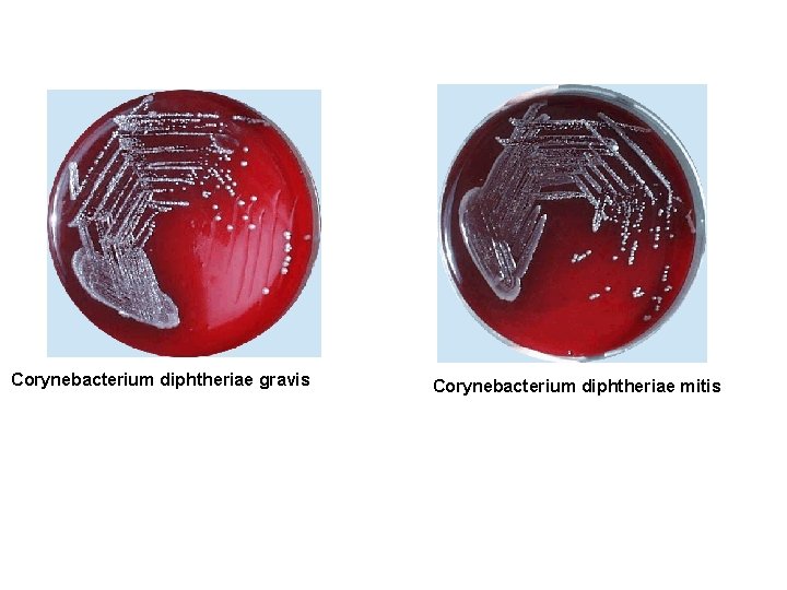 Corynebacterium diphtheriae gravis Corynebacterium diphtheriae mitis 